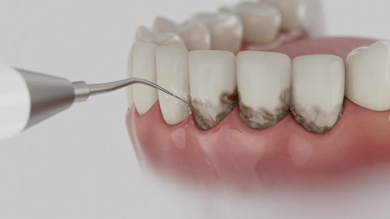 Reliable Dental contractor in Lake Fenton, MI by Dentist Open Now